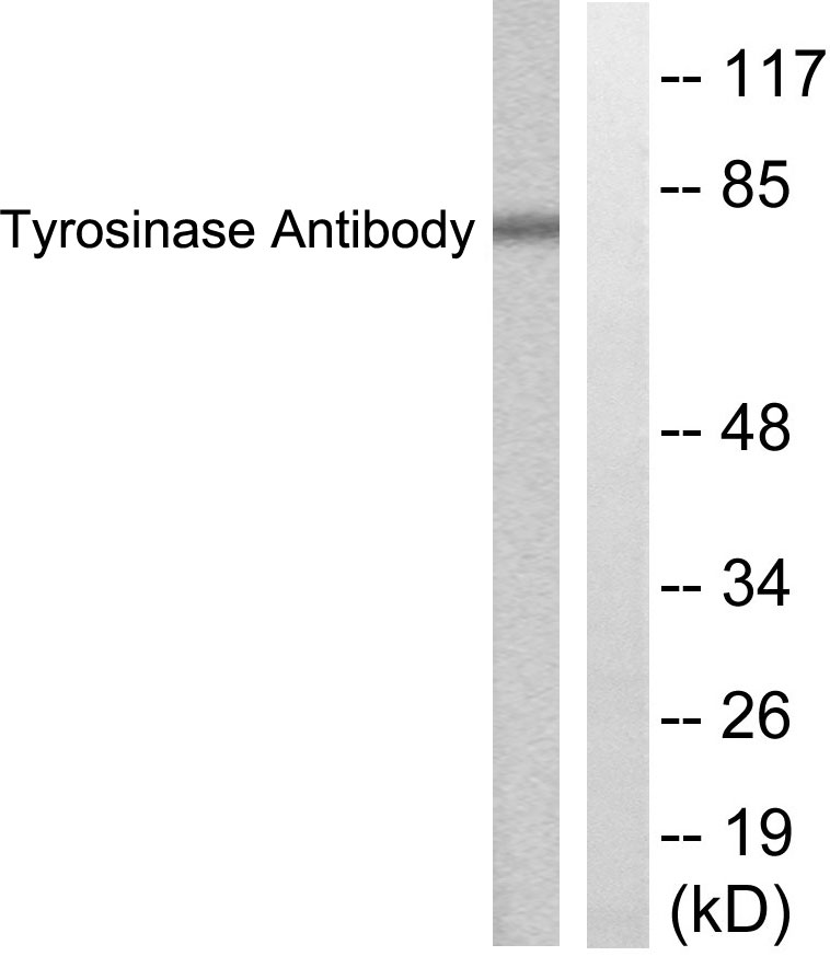 TYR Rabbit Polyclonal Antibody | 兔多抗 | EnkiLife恩玑生命