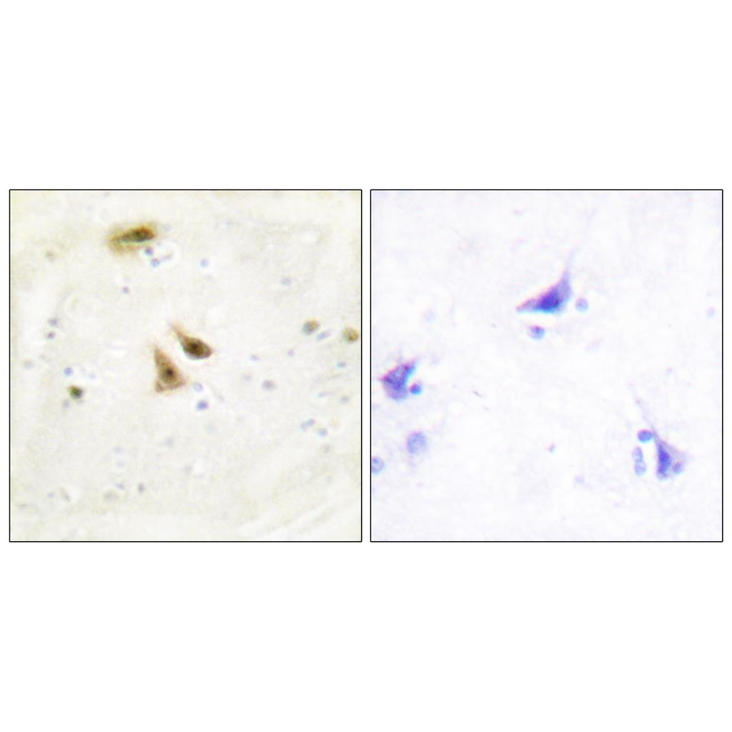 UBF-1 Rabbit Polyclonal Antibody | 兔多抗 | EnkiLife恩玑生命