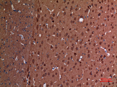 UCH-L1 Rabbit Polyclonal Antibody | 兔多抗 | EnkiLife恩玑生命