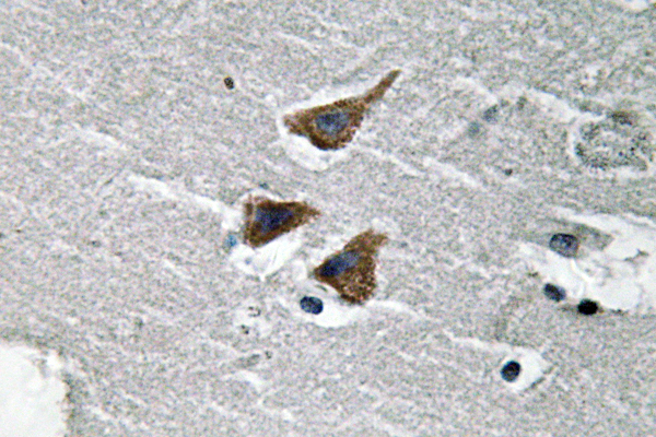 uPA Rabbit Polyclonal Antibody | 兔多抗 | EnkiLife恩玑生命