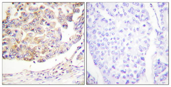 Vav Rabbit Polyclonal Antibody | 兔多抗 | EnkiLife恩玑生命