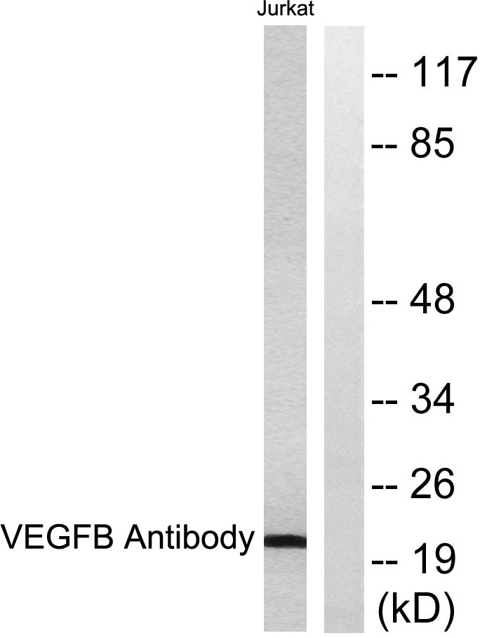 VEGF-B Rabbit Polyclonal Antibody | 兔多抗 | EnkiLife恩玑生命