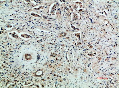 VEGFR2 Rabbit Polyclonal Antibody | 兔多抗 | EnkiLife恩玑生命