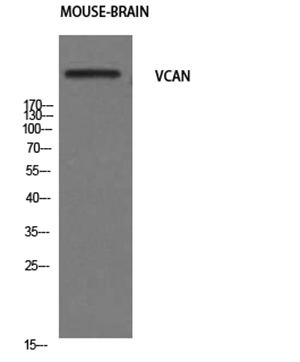 Versican Rabbit Polyclonal Antibody | 兔多抗 | EnkiLife恩玑生命