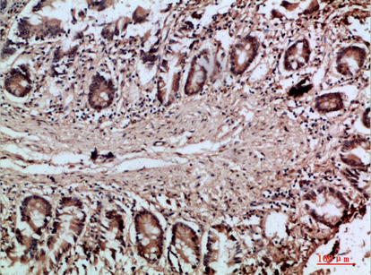 Villin Rabbit Polyclonal Antibody | 兔多抗 | EnkiLife恩玑生命