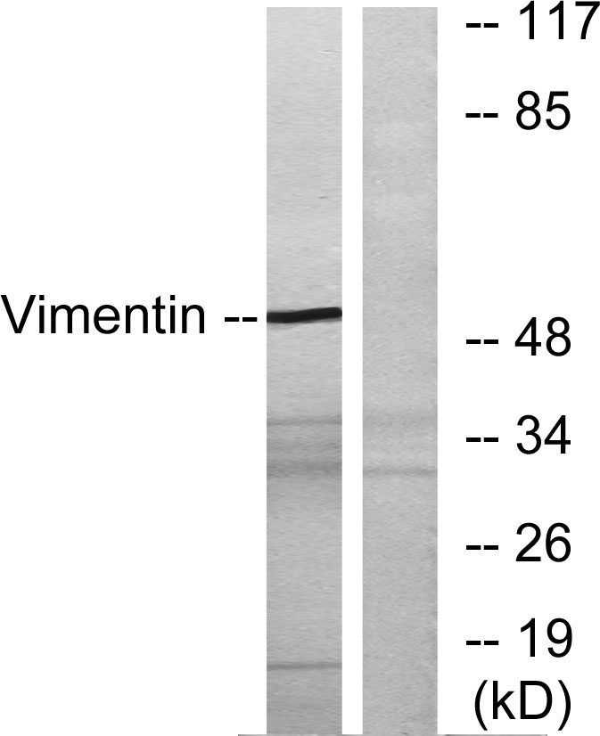 Vimentin Rabbit Polyclonal Antibody | 兔多抗 | EnkiLife恩玑生命
