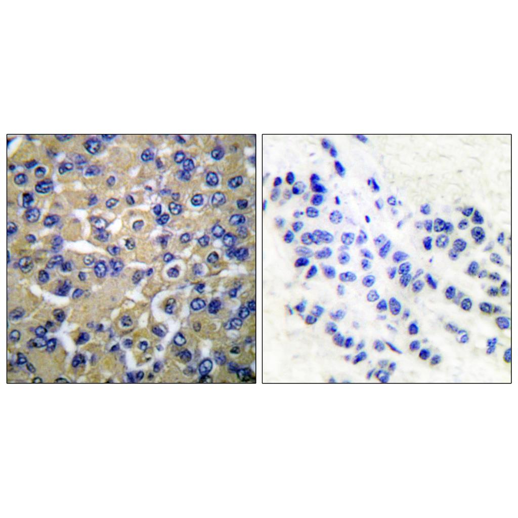 WNK1 Rabbit Polyclonal Antibody | 兔多抗 | EnkiLife恩玑生命