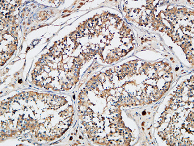 XIAP Rabbit Polyclonal Antibody | 兔多抗 | EnkiLife恩玑生命