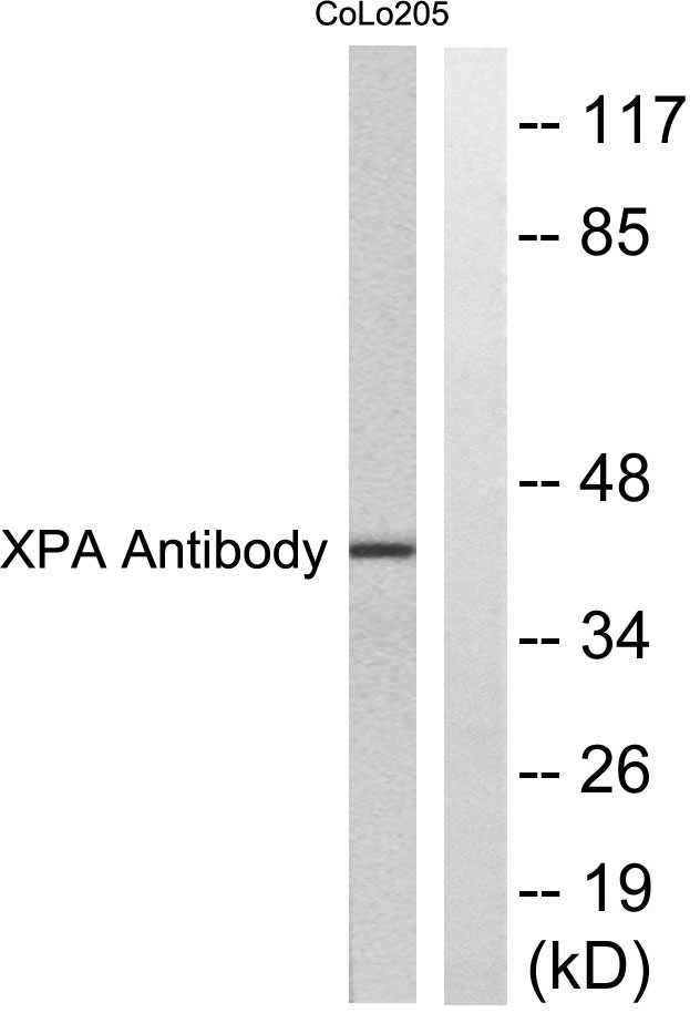XPA Rabbit Polyclonal Antibody | 兔多抗 | EnkiLife恩玑生命