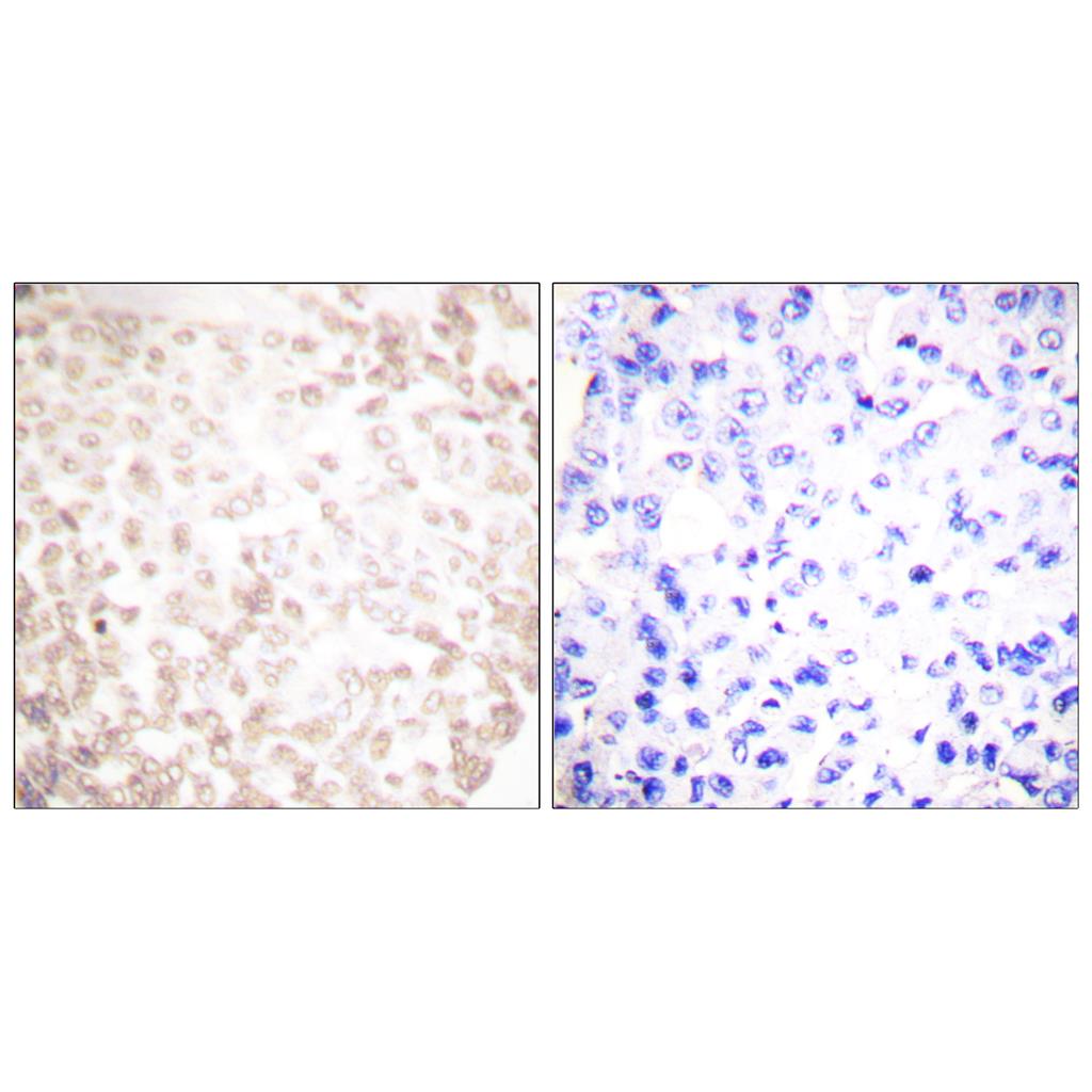 XRCC1 Rabbit Polyclonal Antibody | 兔多抗 | EnkiLife恩玑生命