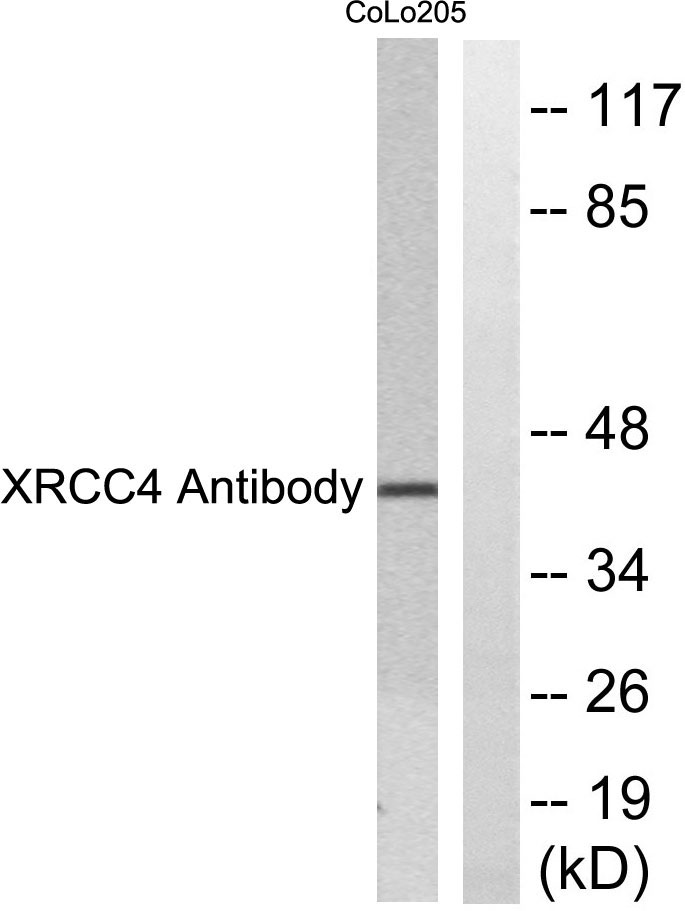 XRCC4 Rabbit Polyclonal Antibody | 兔多抗 | EnkiLife恩玑生命