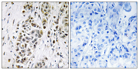 XRN2 Rabbit Polyclonal Antibody | 兔多抗 | EnkiLife恩玑生命