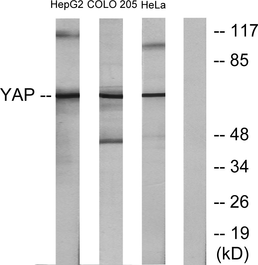 YAP Rabbit Polyclonal Antibody | 兔多抗 | EnkiLife恩玑生命