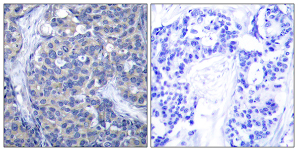 ZAP-70 Rabbit Polyclonal Antibody | 兔多抗 | EnkiLife恩玑生命