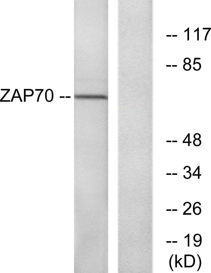 ZAP-70 Rabbit Polyclonal Antibody | 兔多抗 | EnkiLife恩玑生命