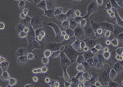 人非小细胞肺癌细胞NCI-H1299/LUC（STR鉴定） | EnkiLife恩玑生命