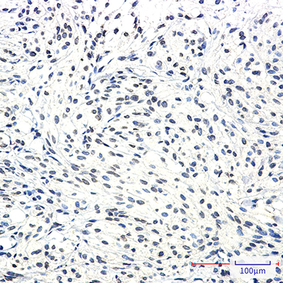 SSX2IP Rabbit Monoclonal Antibody | 兔单抗 | EnkiLife恩玑生命