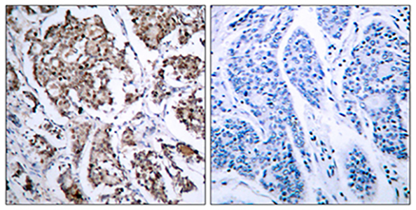 Bad (phospho Ser155) Rabbit Polyclonal Antibody | 兔多抗 | EnkiLife恩玑生命