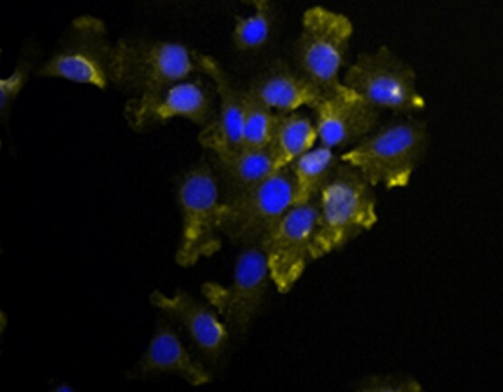 人膀胱癌组织源细胞
