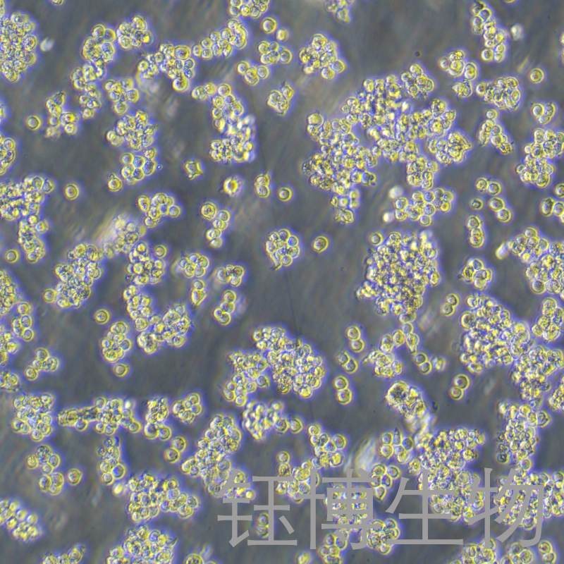 TMD8（人弥漫性大B细胞淋巴瘤）YB-72069HC