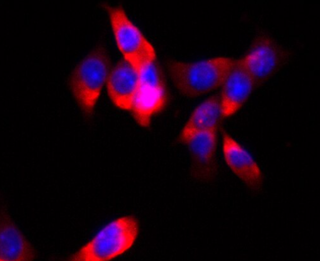 人风湿关节炎成纤维样滑膜细胞