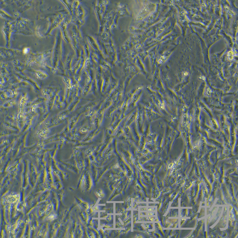 SW900（人肺鳞癌细胞grade IV）YB-72074HC