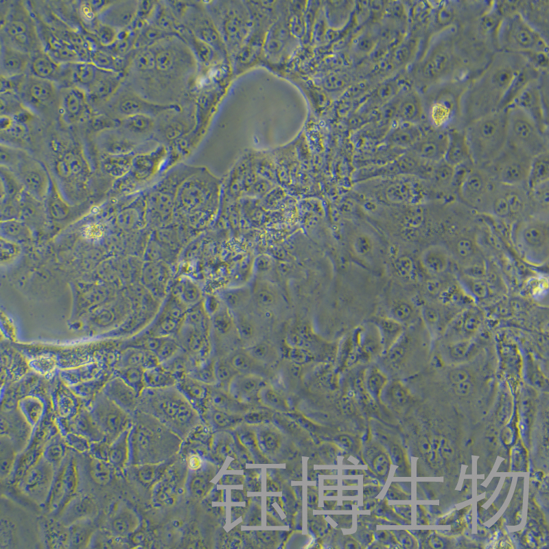 NCI-H820（人肺乳头状腺癌细胞）YB-72104HC