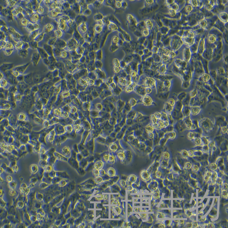 NCI-H1915（人非小细胞肺癌细胞）YB-72108HC