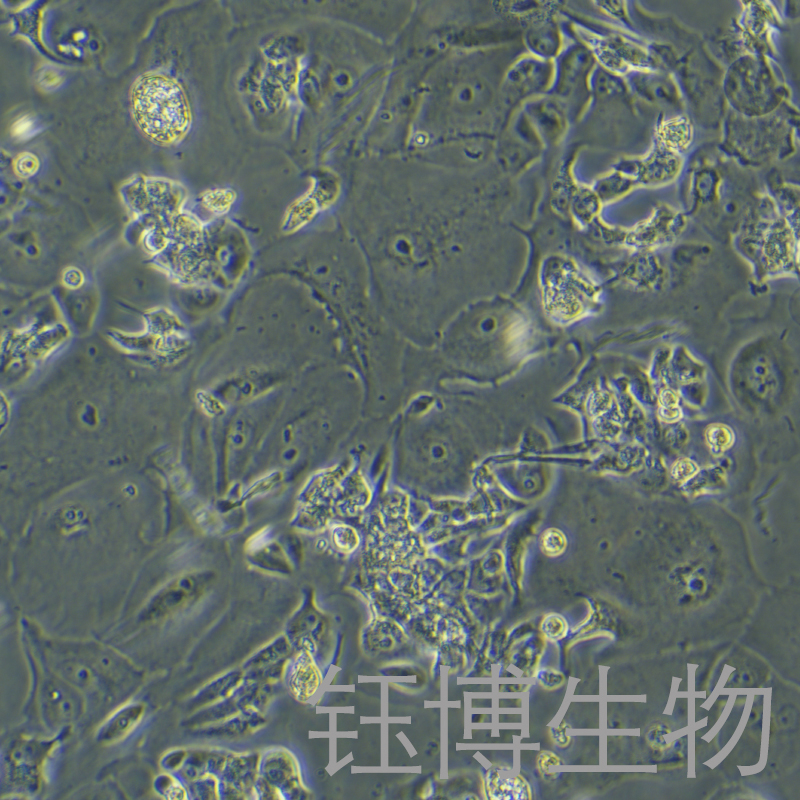 CAMA1（人乳腺腺癌细胞）YB-72127HC