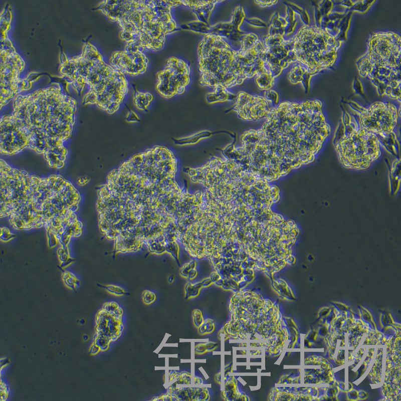 CAL-148（人乳腺癌细胞）YB-72143HC