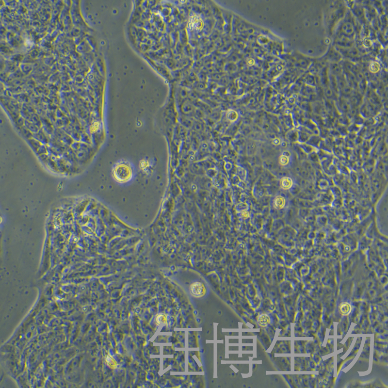 LCLC97TM1（人大细胞肺癌）YB-72146HC
