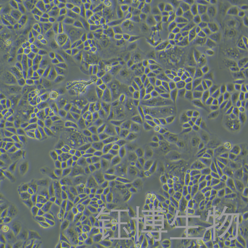 CAL51（人乳腺癌细胞（三阴性））YB-72149HC