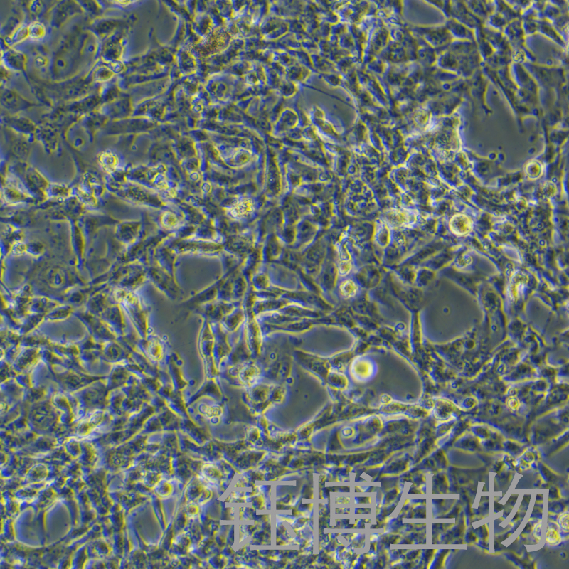 12Z（人源子宫内膜异位细胞）YB-75664HC