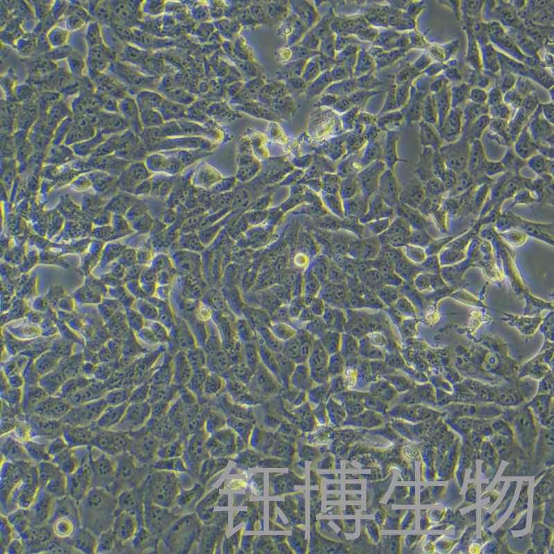 143B-LUC（人骨肉瘤细胞带荧光素酶标记）YB-71695HC-L