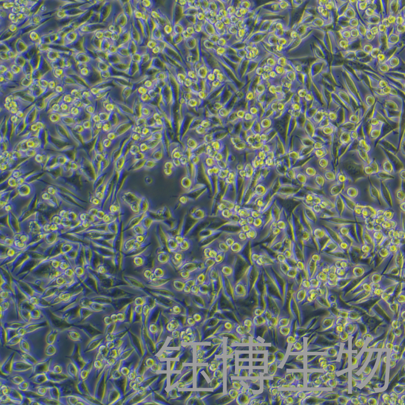 4TO7-TGL（小鼠乳腺恶性肿瘤细胞）YB-75667MC