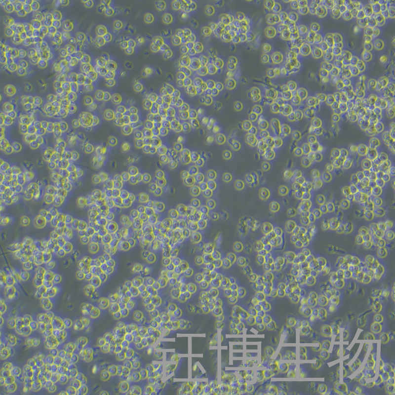 8E5（人外周血淋巴细胞）YB-75669HC