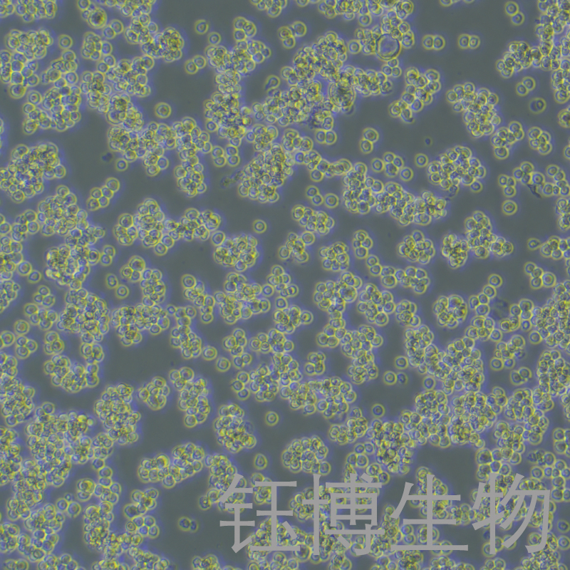 A20-Luc（小鼠B细胞淋巴瘤细胞带荧光素酶）YB-7037MC-L