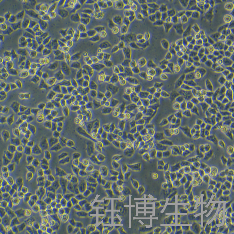 A2780/DDP（人卵巢癌顺铂耐药株）YB-71013HCR