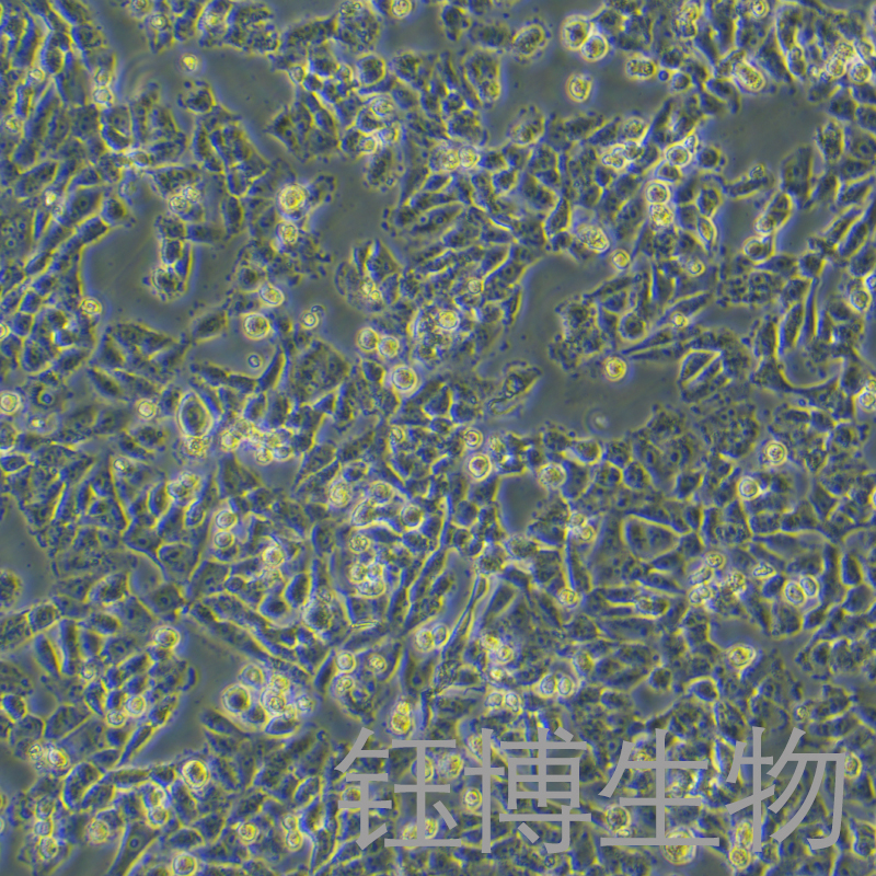 A375/DDP（人恶性黑色素瘤细胞顺铂耐药株）YB-71014HCR