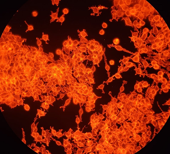 人肝胆管癌细胞SSP-25