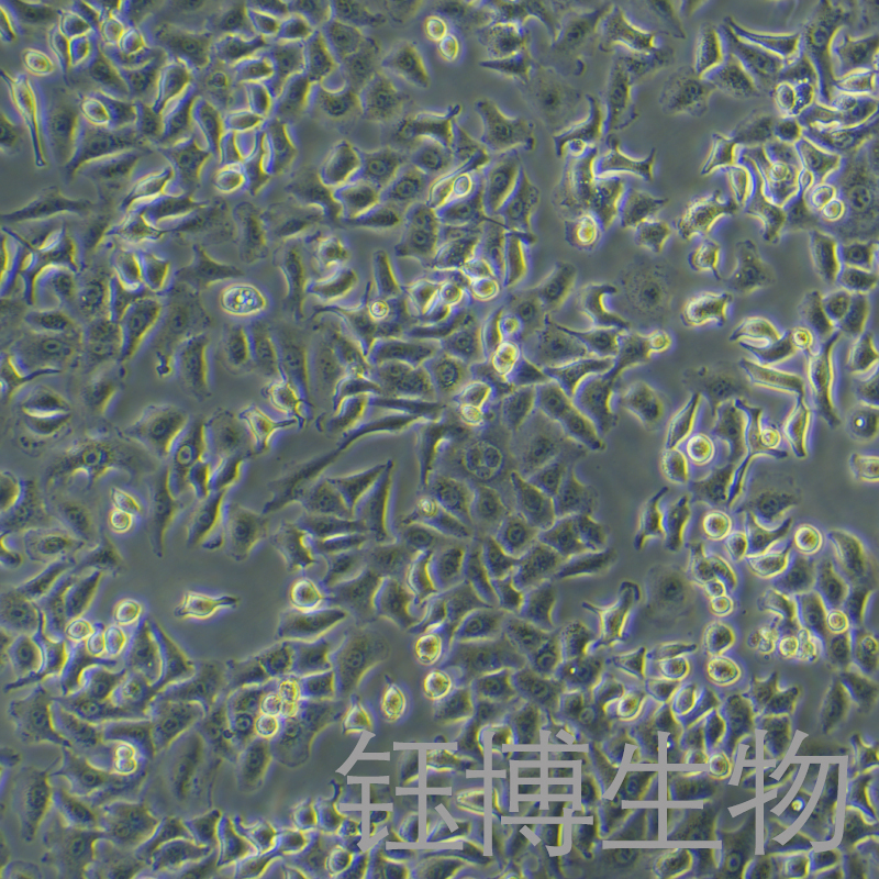 A549-GFP（人肺癌细胞带绿色荧光）YB-71016HC-G