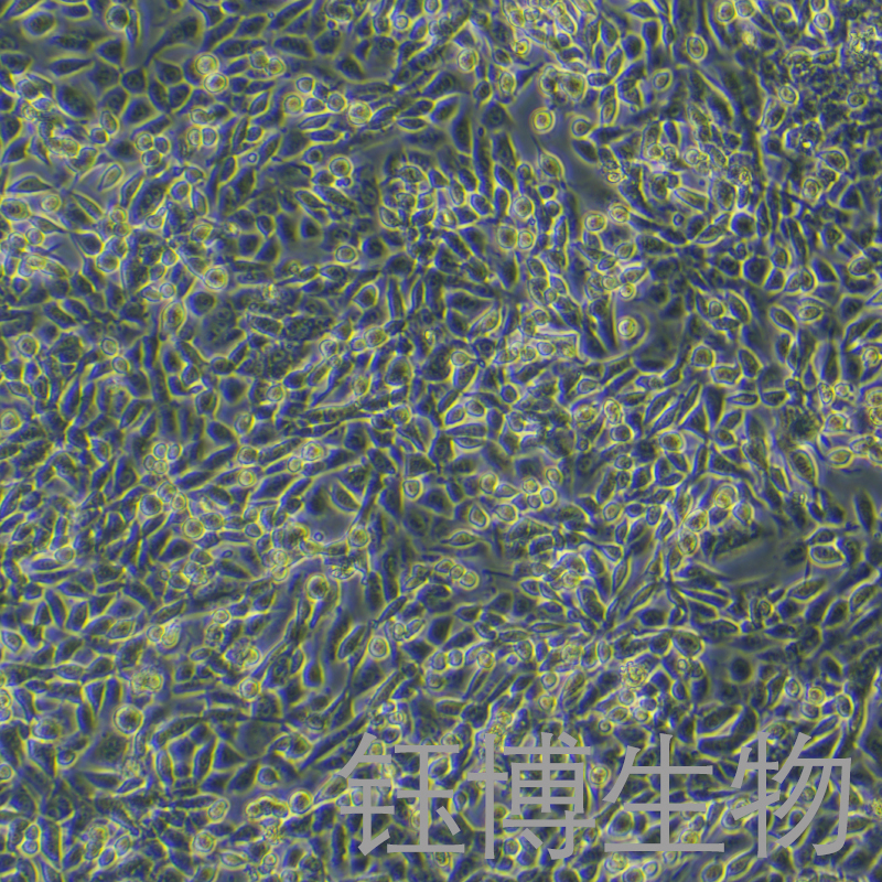 AKR（小鼠食管癌细胞）YB-75672MC