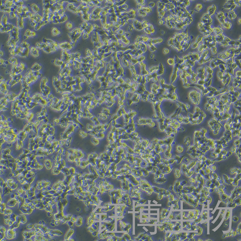 alphaTC1clone6（小鼠胰岛素瘤胰岛a细胞）YB-75673MC