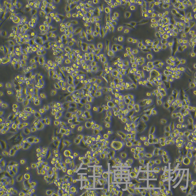 ASPC-1/GEM（人转移胰腺腺癌细胞吉西他滨耐药株）YB-71027HCR