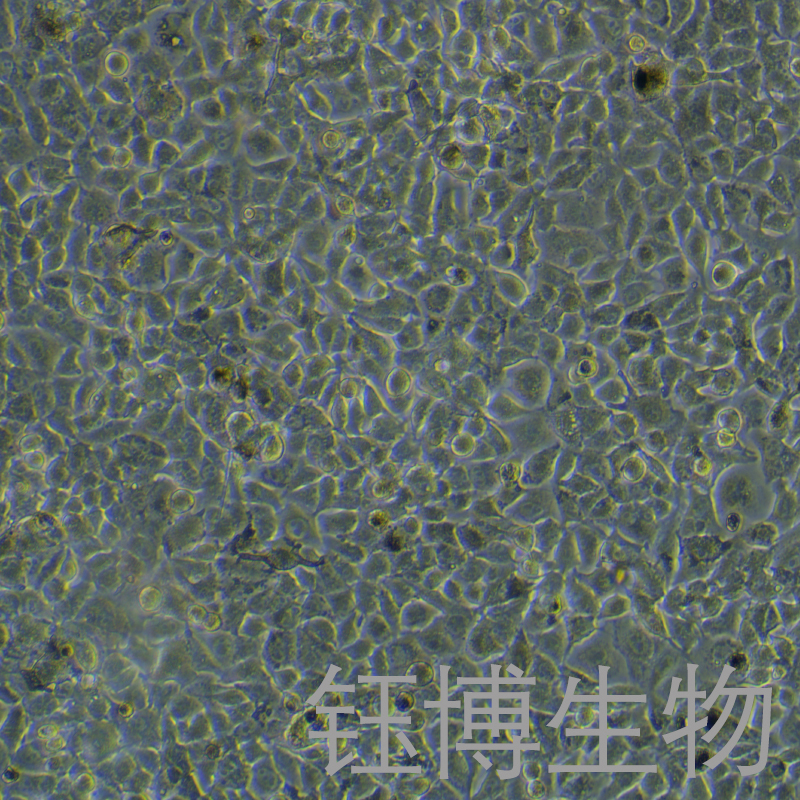B16-F10-OVA（小鼠黑色素瘤细胞）YB-72319MC-OVA