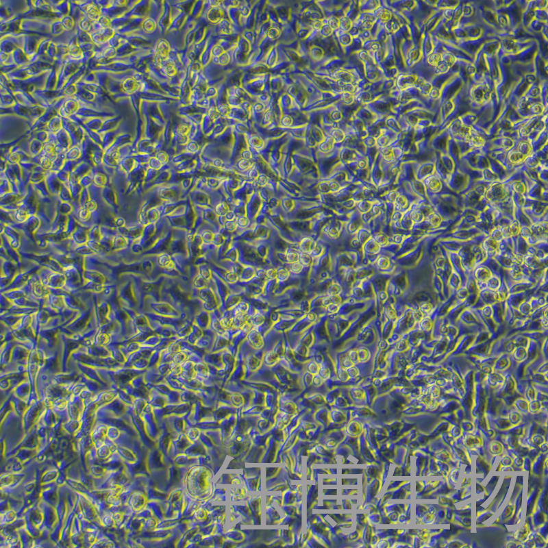 B16+OVA（小鼠黑色素瘤细胞转染）YB-72029MC-OVA