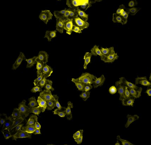 人卵巢癌腺癌细胞NIH:OVCAR-3