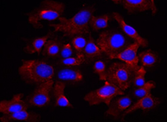 人卵巢癌腺癌细胞NIH:OVCAR-8
