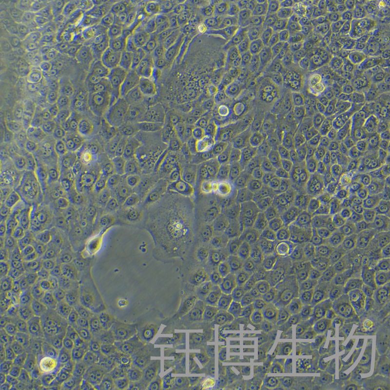 BxPC-3-LUC（人原位胰腺腺癌细胞-荧光素酶标记）YB-71042HC-L