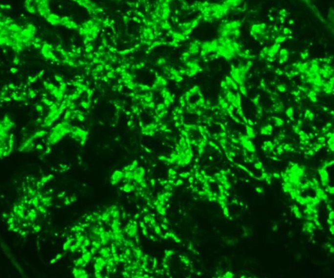人肺大静脉平滑肌细胞